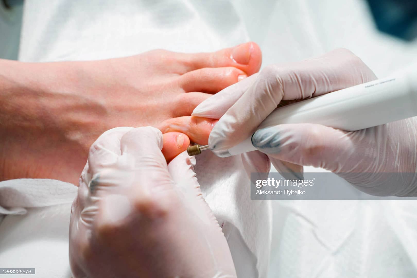 medische manicure